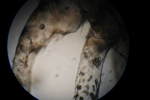 under the microscope